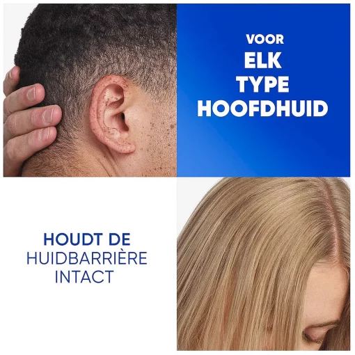 Head and Shoulders Shampoo Apple Fresh - elk type hoofdhuid