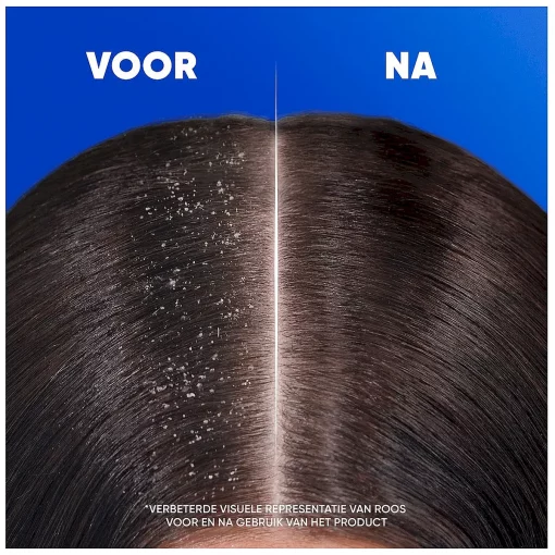 Head and Shoulders Shampoo Apple Fresh - voor en na