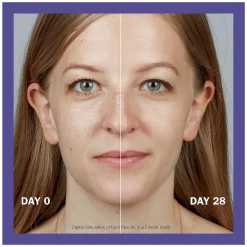 Olay Retinol24 Nachtcrème Met Retinol En Vitamine B3 50ml model voor en na