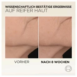 L'Oréal Paris Age Perfect Mikro-Kollagen Serum 30ml 10 L'Oréal Paris Age Perfect Mikro-Kollagen Serum 30ml