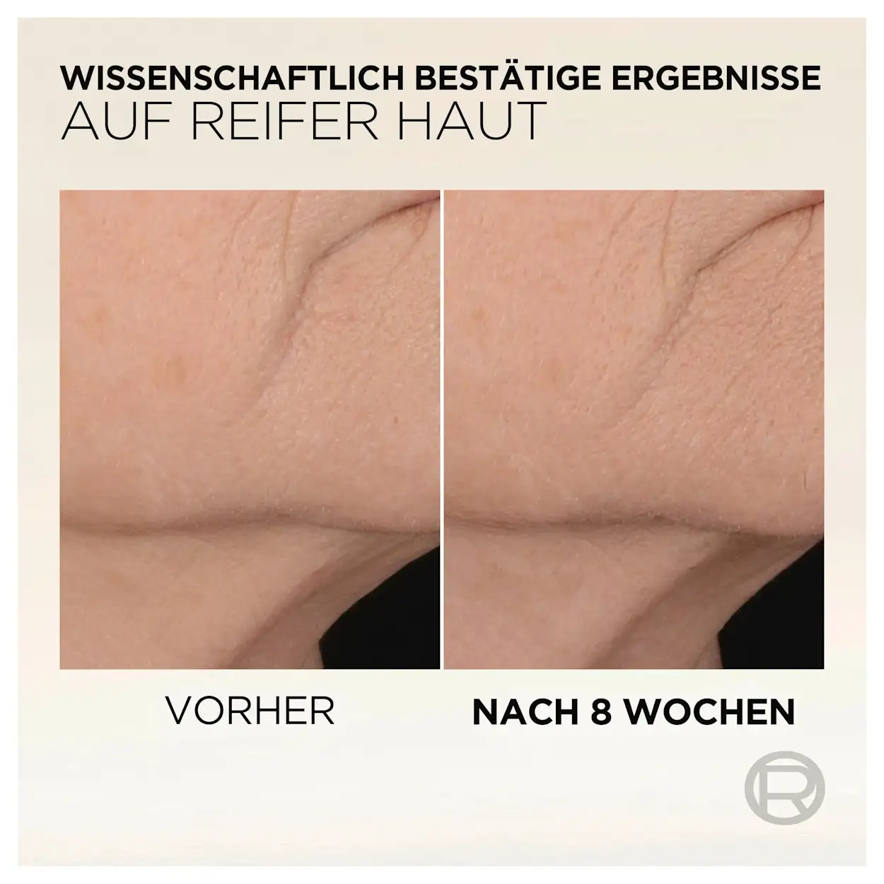 L'Oréal Paris Age Perfect Mikro-Kollagen Serum 30ml 5 L'Oréal Paris Age Perfect Mikro-Kollagen Serum 30ml