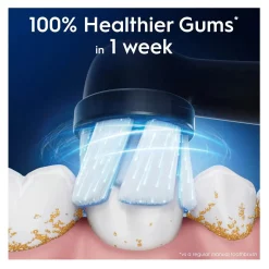 Oral-B Gentle Care Opzetborstels 6-pack